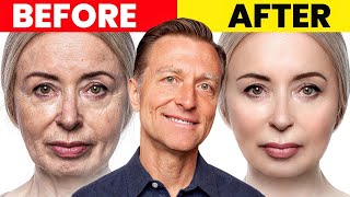 The Ultimate Face Transformation–Dr Bergs Best Remedy for Dry Skin and Wrinkles [upl. by Goldsworthy]