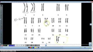 Karyotype analysis [upl. by Dibbrun]