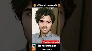 Vijay Deverakonda 💯✅ age transformation journeyvijaydevarakondarashmikamandannaviralshorts [upl. by Eidnyl]