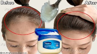 How to use Vaseline for double hair growth your hair will grow 3 times faster [upl. by Jeth491]