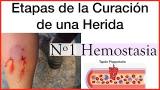 Curación de Heridas Etapa 1 Hemostasia [upl. by Kate]