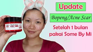 REVIEW SOME BY MI SNAIL TRUECICA MIRACLE REPAIR CREAM KORNELIA LUCIANA [upl. by Cence]