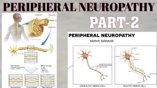 PERIPHERAL NEUROPATHY  PART2  WALLERIAN DISTAL AXONAL DEGENERATION amp SEGMENTAL DEMYELINATION [upl. by Inaliel]