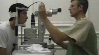 Laser Treatment for Vitreous Floaters  Patient Interview 3 [upl. by Ellyn]