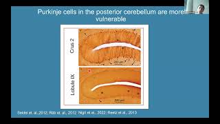 Dr Marija Cvetanovic on quotCerebellar vulnerability in SCA1quot  NAF Science Showcase [upl. by Vins412]