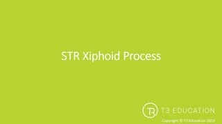 Soft Tissue Release STR xiphoid process [upl. by Odraleba]