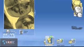 Introduccion CEREC SW 40 en Español [upl. by Zaria]