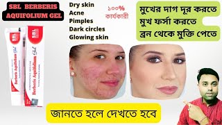 Best Acne Pimple Cream ।। SBL Berberis Aquifolium Gel Benefits ।। Review in Bengali [upl. by Quinn307]