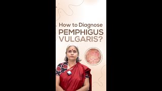 How to Diagnose Pemphigus Vulgaris [upl. by Doralyn]