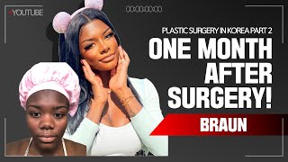 Jaylyns ethnic nose job Rhinoplasty and Facial Contouring Surgery recovery timeline  One month [upl. by Ecenaj706]