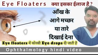 eye floaters  eye floaters treatment  आँख के आगे जाले दिखाई देना  floaters in eye [upl. by Lalla]