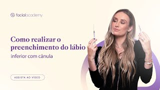 Como realizar o preenchimento do lábio inferior com cânula [upl. by Calloway]