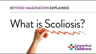 What Is Scoliosis [upl. by Ahsakal]