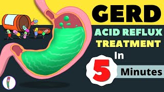 GERD Treatment  Acid Reflux Treatment  Heartburn Treatment  All You Need to Know [upl. by Saylor]