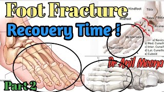 foot fracture recovery time  foot fracture treatment  metatarsal fracture recovery time in hindi [upl. by Stoat482]