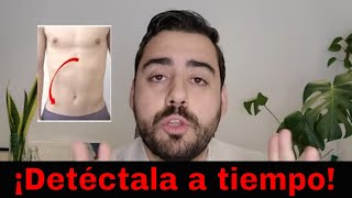 7 señales de que tu dolor de abdomen es apendicitis [upl. by Hsetim213]