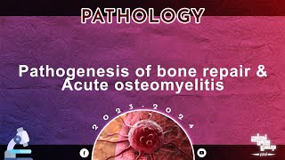 Revision of L12  Pathogenesis of bone repair amp Acute osteomyelitis  Pathology [upl. by Aisatal]