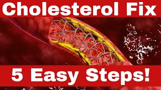 How to Reduce Cholesterol FAST  5 Proven Methods [upl. by Om]