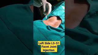 Left Side L5S1 Facet Joint Injection under CArmDr Sai Chandra MBBS DNB Ortho [upl. by Marieann513]