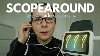 ScopeAround Otoscope Ear Camera See whats inside my ears [upl. by Roshan]