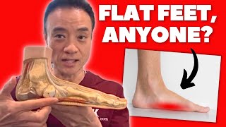 How To Fix Flat Feet With InsolesOrthotics [upl. by Nivlem]