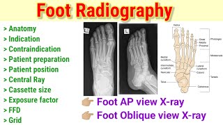 Foot Radiography  Foot AP view  Foot Oblique view xray radiography  By BL kumawat [upl. by Boote]