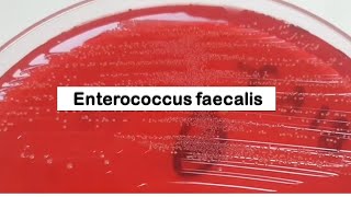 Enterococcus faecalis Colony Morphology on CLED Agar [upl. by Ledniahs775]