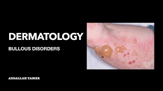 PEMPHIGUS VULGARIS  BULLOUS PEMPHIGOID  بالعربي [upl. by Yesnel]