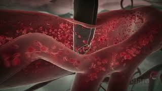 Malaria 3D Animation Shows How the Infection Spreads in the Body [upl. by Coke376]