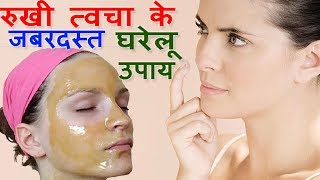 रुखी त्वचा के जबरदस्त घरेलू उपाय Dry Skin Treatment at Home in Hindi  Beauty Tips [upl. by Letsirc]