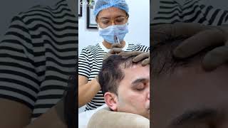 Cara Clinic Hair PRP Treatment Everything You Need to Know [upl. by Tanah]