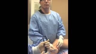 Video demonstrating vein ablation from start to finish [upl. by Assel963]