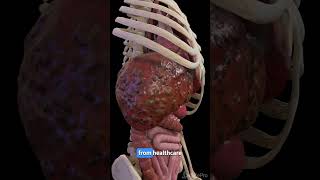 Understanding Liver Cirrhosis Key Facts anatomy meded 3dmodel [upl. by Tadd]