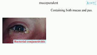 mucopurulent English  Medical terminology for medical students [upl. by Dall]