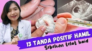 13 Tanda Positif Hamil sebelum Telat Haid  dr Emasuperr [upl. by Haywood]