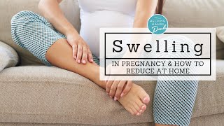 Pregnancy Hacks How to Reduce Swelling at Home [upl. by Calvert]