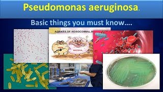 Pseudomonas aureginosaClear overview [upl. by Pember]