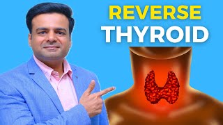 3 Step Process To Reverse Hashimotos Naturally  How To Reverse Thyroid Naturally [upl. by Nishi]