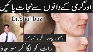 Acne Treatment At Home  Pimples Removel Cream  Acne Soap  Skin Care [upl. by Ahtivak989]