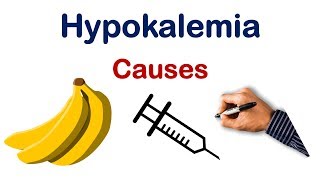 Hypokalemia  USMLE Step COMLEX NCLEX [upl. by Tiersten]