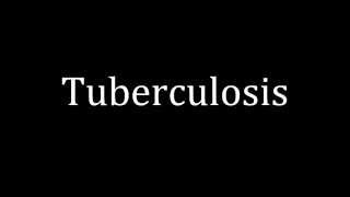 How to pronounce Tuberculosis [upl. by Aisemaj308]