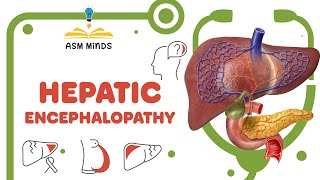 Hepatic Encephalopathy [upl. by Carlick]