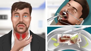 ASMR Animation Help MrBeast remove fish bones stuck in his throat [upl. by Sualkcin]