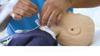 UCSF Routine Tracheostomy Tie Change [upl. by Einre]