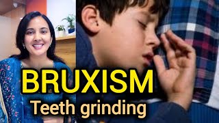 Teeth grinding myths teeth childhealth worms sparshclinicpanchkula [upl. by Sulamith]