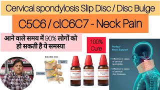 Cervical Spondylosis Permanent Treatment in Homeopathy  गर्दन के दर्द का इलाज  Best Treatment [upl. by Leonid49]