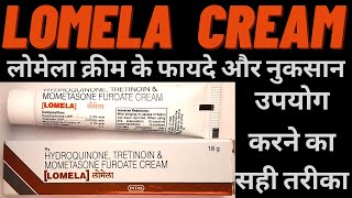 lomela cream use in Hindi benefits how to use lomela cream side and effects [upl. by Rome415]