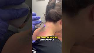 The Most Satisfying Tattoo Removal 😳 [upl. by Mccormac]