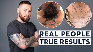 Laser Tattoo Removal  Real People True Results [upl. by Nirrac56]