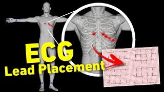 ECG lead placement MADE EASY  12 lead ECG placement  How to perform ECG • Daily Cardiology [upl. by Grussing918]